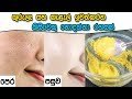 Use this remedy to cure your pimples 03-08-2019