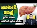 How to cure of Fatty Liver 30-10-2019
